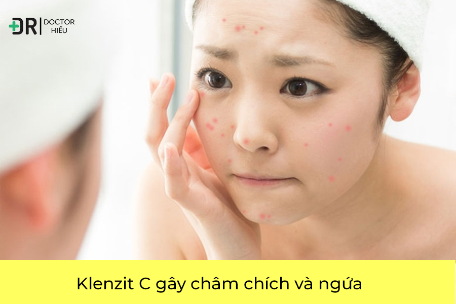 Klenzit C gây châm chích và ngứa