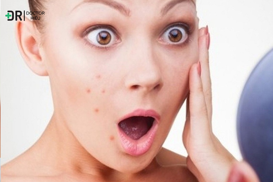 Klenzit C gây mẩn đỏ