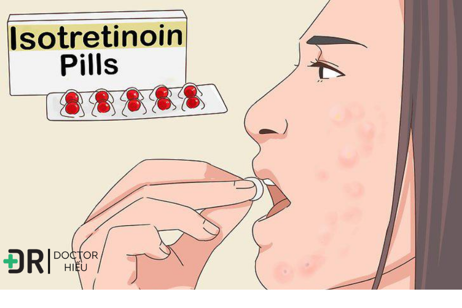 ISOTRETINOIN có phải cách DUY NHẤT trị mụn , tretinoin , retinol là gì