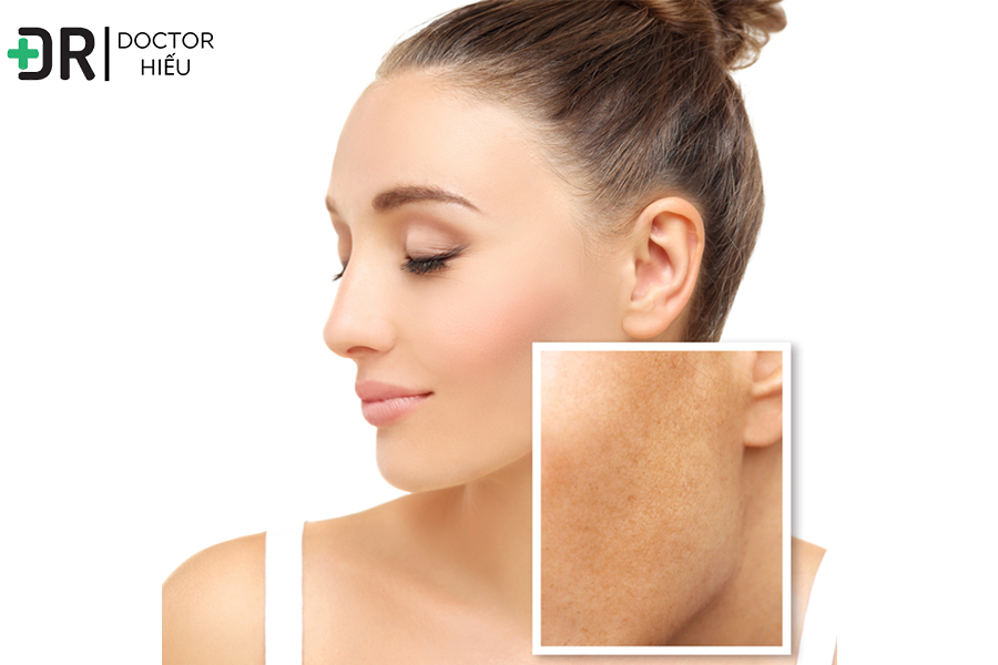 Làn da - cấu trúc và những điều cơ bản cần biết - BÁC SĨ HIẾU