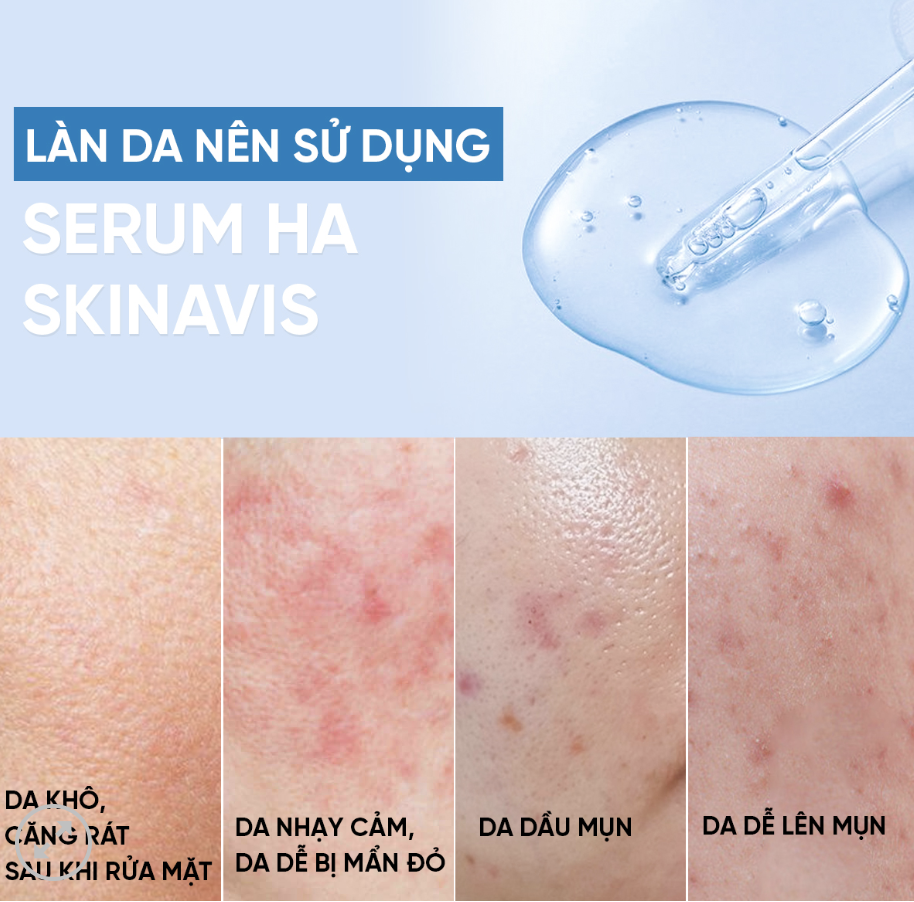 serum HA Skinavis